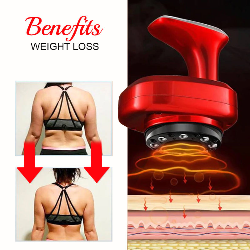 Luma-Radiance CelluMax Cellulite Blaster™