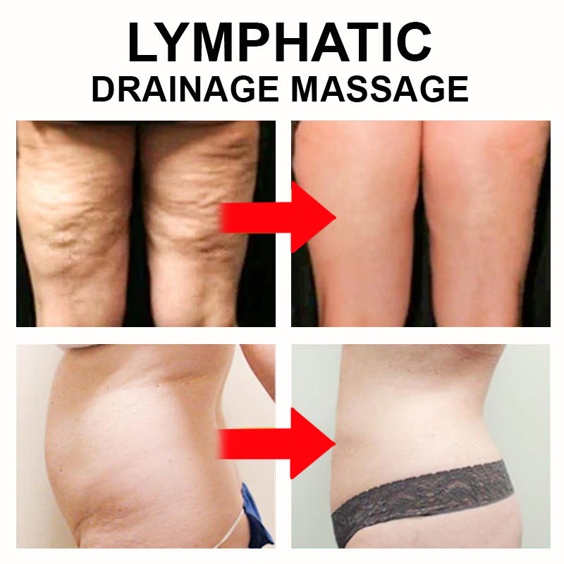 Luma-Radiance CelluMax Cellulite Blaster™