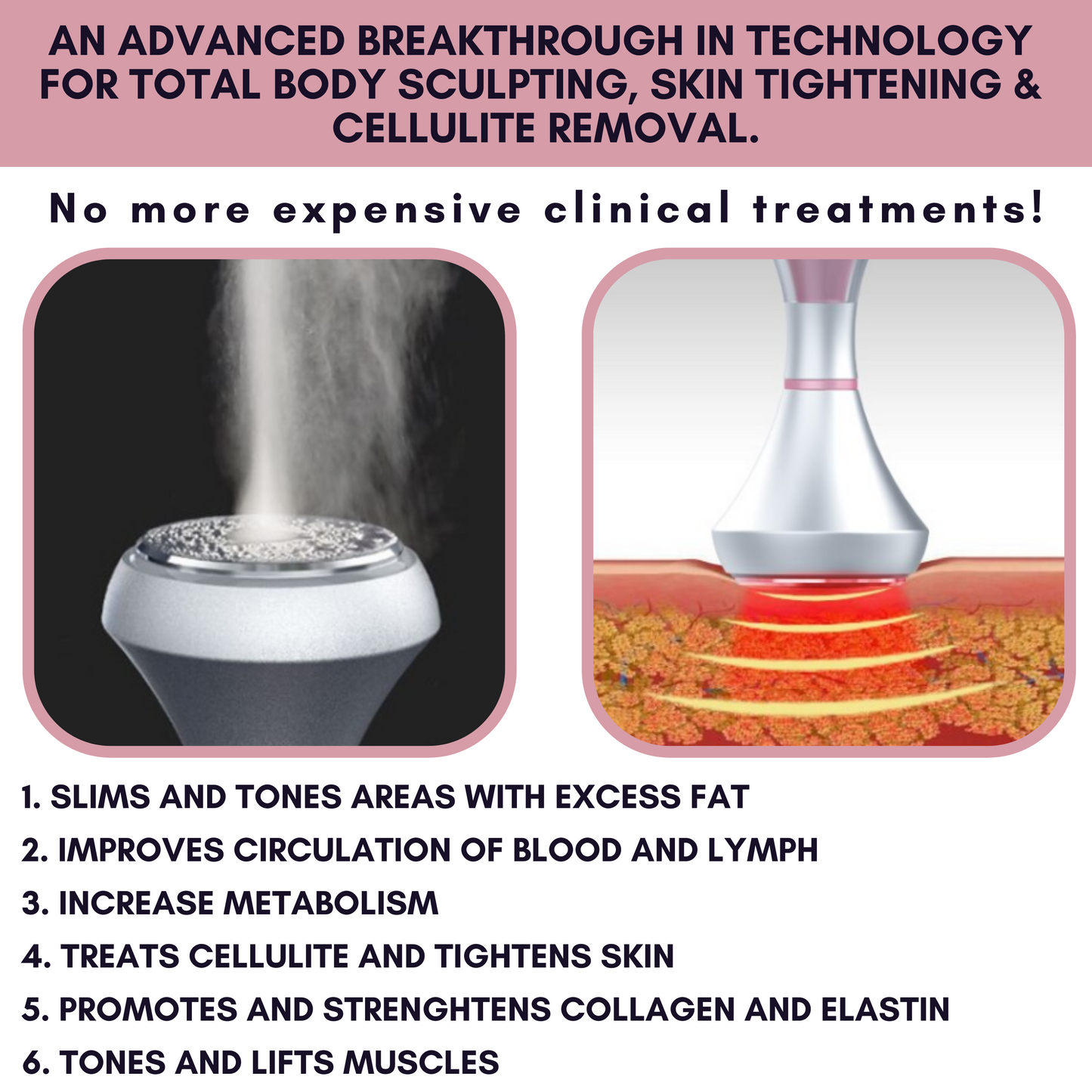 Luma “6 In 1” 80K Smart Lipo-Cavitation™